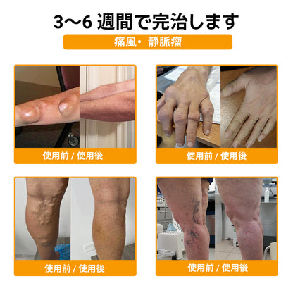 ZUWIAY® ハチ毒配合 痛み緩和・関節ケア・骨サポートクリーム 🎊🎊（膝・腰・肩・手首など全身ケア／中高年の方の運動の柔軟性と日常の快適さをサポート）